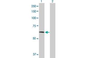 Western Blot analysis of FGFR1 expression in transfected 293T cell line by FGFR1 MaxPab polyclonal antibody. (FGFR1 Antikörper  (AA 1-731))