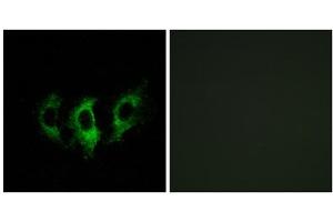 Immunofluorescence analysis of A549 cells, using GFM2 antibody. (GFM2 Antikörper  (Internal Region))