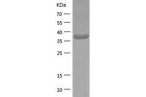 Western Blotting (WB) image for Creatine Kinase, Brain (CKB) (AA 1-381) protein (His tag) (ABIN7122491) (CKB Protein (AA 1-381) (His tag))