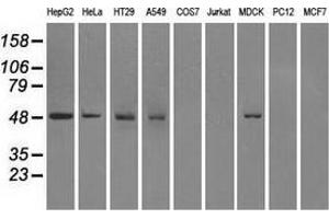 Western blot analysis of extracts (35 µg) from 9 different cell lines by using anti-FH monoclonal antibody. (FH Antikörper)