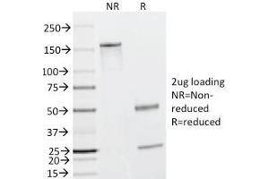 SDS-PAGE Analysis Purified Caldesmon Mouse Monoclonal Antibody (h-CALD). (Caldesmon Antikörper)