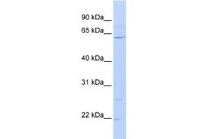 WB Suggested Anti-ZNF680 Antibody Titration:  0. (ZNF680 Antikörper  (N-Term))