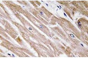 Immunohistochemistry analysis of BMP-5 Antibody in paraffin-embedded human heart tissue. (BMP5 Antikörper)
