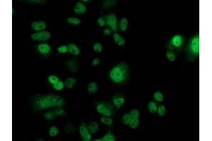 Immunofluorescence (IF) image for anti-Tumor Protein P53 (TP53) antibody (ABIN1499968) (p53 Antikörper)