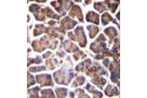 Immunohistochemistry (Paraffin-embedded Sections) (IHC (p)) image for anti-GNAS Complex Locus (GNAS) (AA 286-315), (C-Term) antibody (ABIN952563)