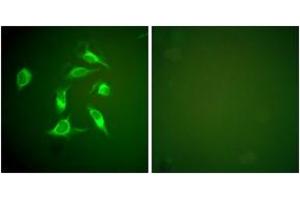 Immunofluorescence analysis of HeLa cells, using PDGFR alpha Antibody. (PDGFRA Antikörper  (AA 1031-1080))