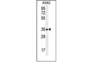 Western blot analysis of ETV2 / ER71 Antibody (N-term) Cat. (ETV2 Antikörper  (N-Term))