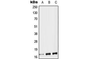 Western blot analysis of Protachykinin 1 expression in HEK293T (A), SP2/0 (B), H9C2 (C) whole cell lysates. (TAC1 Antikörper  (Center))