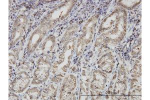 Immunoperoxidase of monoclonal antibody to PNMA1 on formalin-fixed paraffin-embedded human stomach. (PNMA1 Antikörper  (AA 62-160))