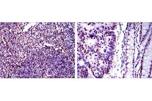 Immunohistochemistry (IHC) image for anti-X-Ray Repair Complementing Defective Repair in Chinese Hamster Cells 5 (Double-Strand-Break Rejoining) (XRCC5) antibody (ABIN969463)