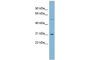 WB Suggested Anti-MRPL28 Antibody Titration: 0. (MRPL28 Antikörper  (Middle Region))