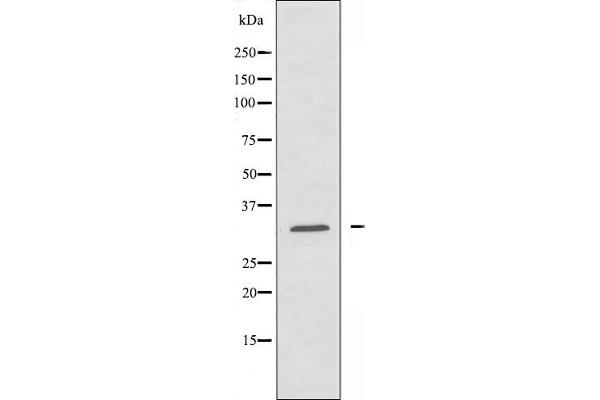 CIB3 Antikörper  (C-Term)