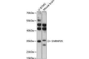 Western blot analysis of extracts of various cell lines, using SNRNP35 antibody (ABIN6132757, ABIN6148206, ABIN6148207 and ABIN6217126) at 1:3000 dilution. (SNRNP35 Antikörper  (AA 1-150))