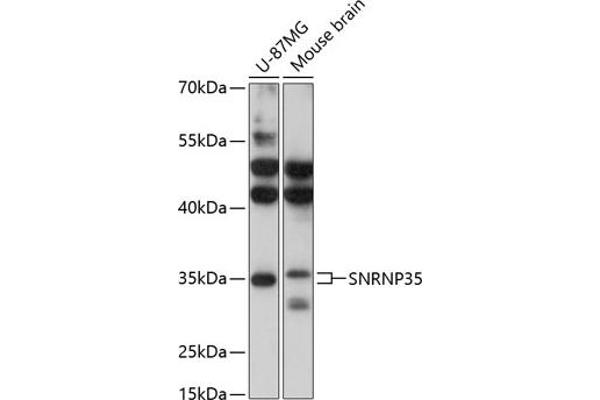SNRNP35 抗体  (AA 1-150)