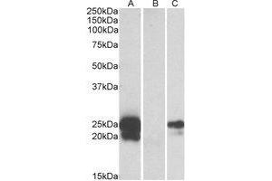 Western Blotting (WB) image for anti-WAP Four-Disulfide Core Domain 2 (WFDC2) (Internal Region) antibody (ABIN2464648) (WFDC2 Antikörper  (Internal Region))