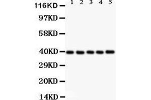 Anti- CXCR6 antibody,  Western blotting All lanes: Anti CXCR6 () at 0. (CXCR6 Antikörper  (C-Term))