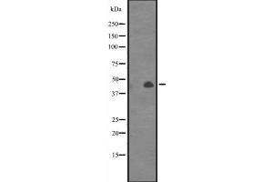 Western blot analysis of CANT1 expression in Jurkat cell line lysates,The lane on the left is treated with the antigen-specific peptide. (CANT1 Antikörper  (Internal Region))
