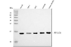 Western blot analysis of RPS15A using anti-RPS15A antibody (ABIN7598954). (RPS15A Antikörper  (AA 1-113))