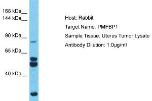 Host: Rabbit Target Name: PMFBP1 Sample Type: Uterus Tumor lysates Antibody Dilution: 1. (PMFBP1 Antikörper  (Middle Region))