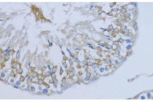 Immunohistochemistry (Paraffin-embedded Sections) (IHC (p)) image for anti-Neuregulin 4 (NRG4) antibody (ABIN7260591)