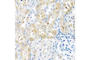 Immunohistochemistry (Paraffin-embedded Sections) (IHC (p)) image for anti-Gonadotropin-Releasing Hormone 2 (GnRH2) (AA 24-120) antibody (ABIN6141259)