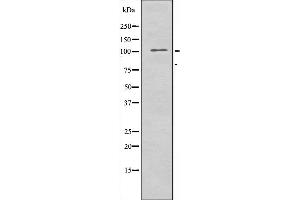 Western blot analysis of extracts from 3T3 cells using ATXN2L antibody. (Ataxin 2-Like Antikörper  (Internal Region))