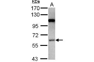 Image no. 2 for anti-Mitogen-Activated Protein Kinase Kinase Kinase 3 (MAP3K3) (Internal Region) antibody (ABIN1496076)