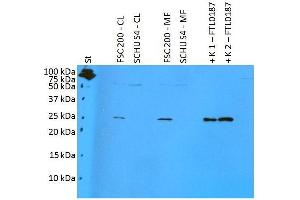 Western blotting analysis of polyclonal anti-Francisella tularensis subsp. (FTL0187 Antikörper)