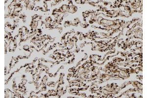 ABIN6272508 at 1/100 staining Human lung tissue by IHC-P. (MAGEA8 Antikörper  (C-Term))
