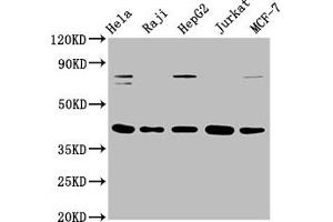 Western Blot Positive WB detected in: Hela whole cell lysate, Raji whole cell lysate, HepG2 whole cell lysate, Jurkat whole cell lysate, MCF-7 whole cell lysate All lanes: FEN1 antibody at 0. (Rekombinanter FEN1 Antikörper)