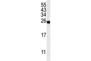 Western blot analysis of SPR antibody and mouse liver tissue lysate. (SPR Antikörper  (AA 231-260))