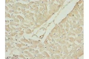 Immunohistochemistry of paraffin-embedded human heart tissue using ABIN7167204 at dilution of 1:100 (RAC3 Antikörper  (AA 1-192))