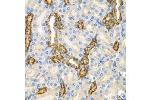 Immunohistochemistry of paraffin-embedded mouse kidney using CNPY3 antibody. (TNRC5 Antikörper)