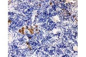 IHC-P: Leupaxin antibody testing of rat spleen tissue (Leupaxin Antikörper  (N-Term))