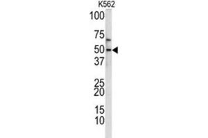 Western Blotting (WB) image for anti-Kruppel-Like Factor 11 (KLF11) antibody (ABIN3002716) (KLF11 Antikörper)