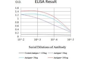 Black line: Control Antigen (100 ng),Purple line: Antigen (10 ng), Blue line: Antigen (50 ng), Red line:Antigen (100 ng) (SARS-Cov2-NP2 (AA 120-300) Antikörper)