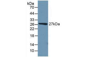 Western blot analysis of recombinant Mouse PCK1. (PCK1 Antikörper  (AA 312-563))