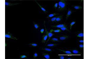 Immunofluorescence of purified MaxPab antibody to ZFYVE16 on HeLa cell. (ZFYVE16 Antikörper  (AA 1-809))