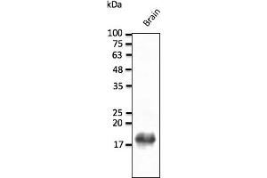 Western Blotting (WB) image for anti-Synuclein, beta (SNCB) (C-Term) antibody (ABIN7273028)