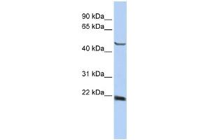WB Suggested Anti-SSX4 Antibody Titration:  0. (SSX4 Antikörper  (Middle Region))