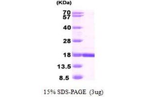 SDS-PAGE (SDS) image for Retinol Binding Protein 7, Cellular (RBP7) (AA 1-134) protein (His tag) (ABIN667367)