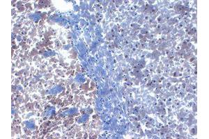 PICK1 Immunohistochemistry. (PICK1 Antikörper)