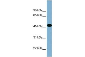 WB Suggested Anti-ITPK1 Antibody Titration: 0. (ITPK1 Antikörper  (Middle Region))