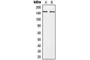 Western blot analysis of PALLD expression in HeLa (A), PC3 (B) whole cell lysates.