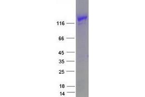 Western Blotting (WB) image for Myosin Binding Protein C, Cardiac (MYBPC3) protein (Myc-DYKDDDDK Tag) (ABIN2726624)