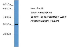 Host: Rabbit Target Name: GCH1 Sample Tissue: Human Fetal Heart Antibody Dilution: 1ug/ml (GCH1 Antikörper  (N-Term))