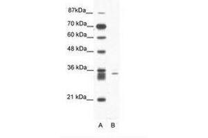 Image no. 1 for anti-E3 Ubiquitin-Protein Ligase SIAH1 (SIAH1) (N-Term) antibody (ABIN203050) (SIAH1 Antikörper  (N-Term))