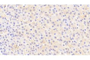 Immunohistochemistry (IHC) image for anti-Matrix Metallopeptidase 13 (Collagenase 3) (MMP13) (AA 290-468) antibody (ABIN7438484)