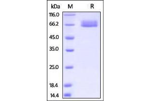 SDS-PAGE (SDS) image for Interleukin 4 Receptor (IL4R) (AA 26-232) protein (Fc Tag) (ABIN2870597)
