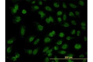 Image no. 3 for anti-Forkhead Box R2 (FOXR2) (AA 1-312) antibody (ABIN599326) (FOXR2 Antikörper  (AA 1-312))